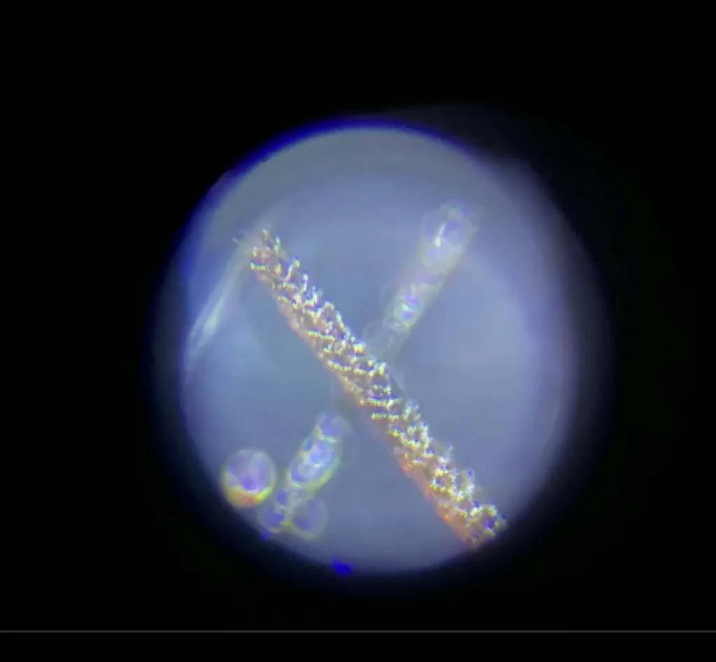 Microscope analysis of the hair sample proven to be Bigfoot hair
